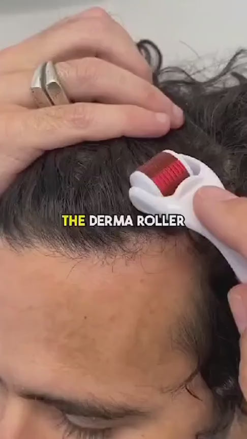 Start Your Hair Growth Journey with the Derma Roller!